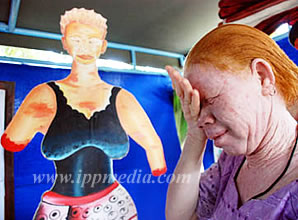 Foto: Ippmedia Albinos in Tansania