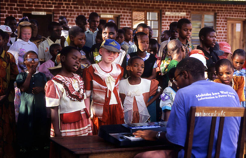 Foto: Peter Harke Menschen mit Albinismus in Bagamoyo